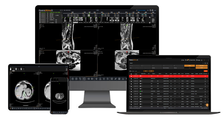 Web Based Pacs PaxeraUltima Features